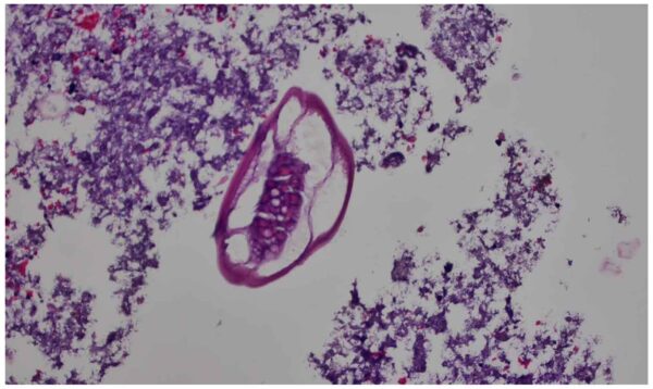 Nemathelminthes