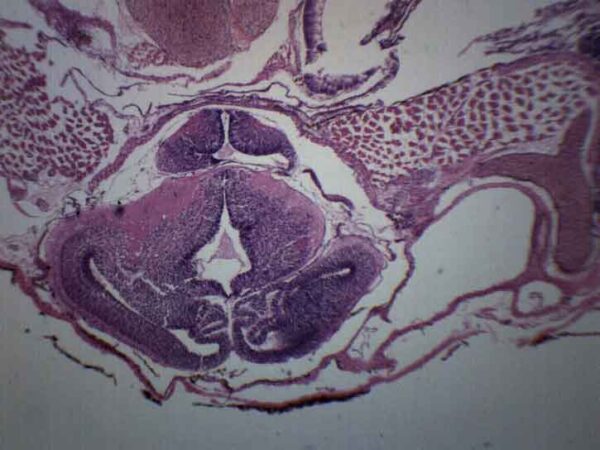 Frog Embryology